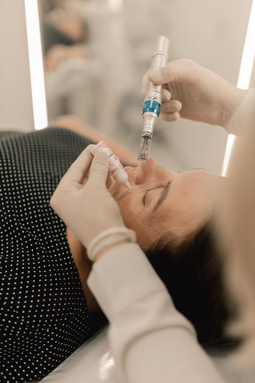 Microneedling facial — imagen ilustrativa